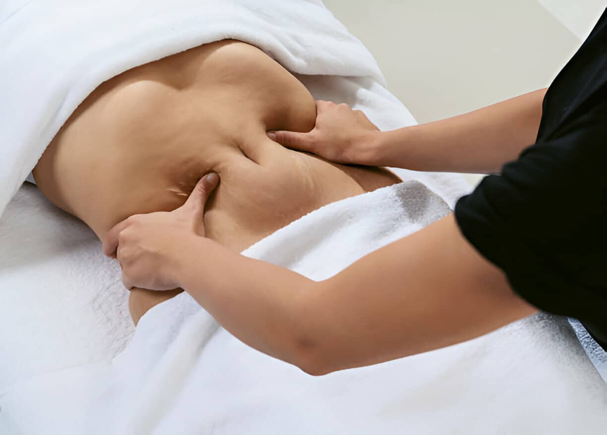 tratamiento celulitis