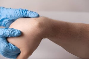 Ganglión en la muñeca: causas, síntomas y tratamiento