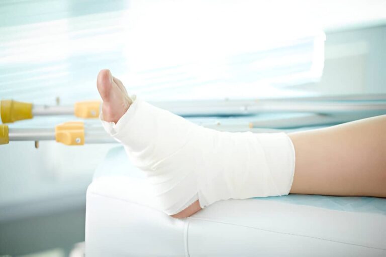 fractura