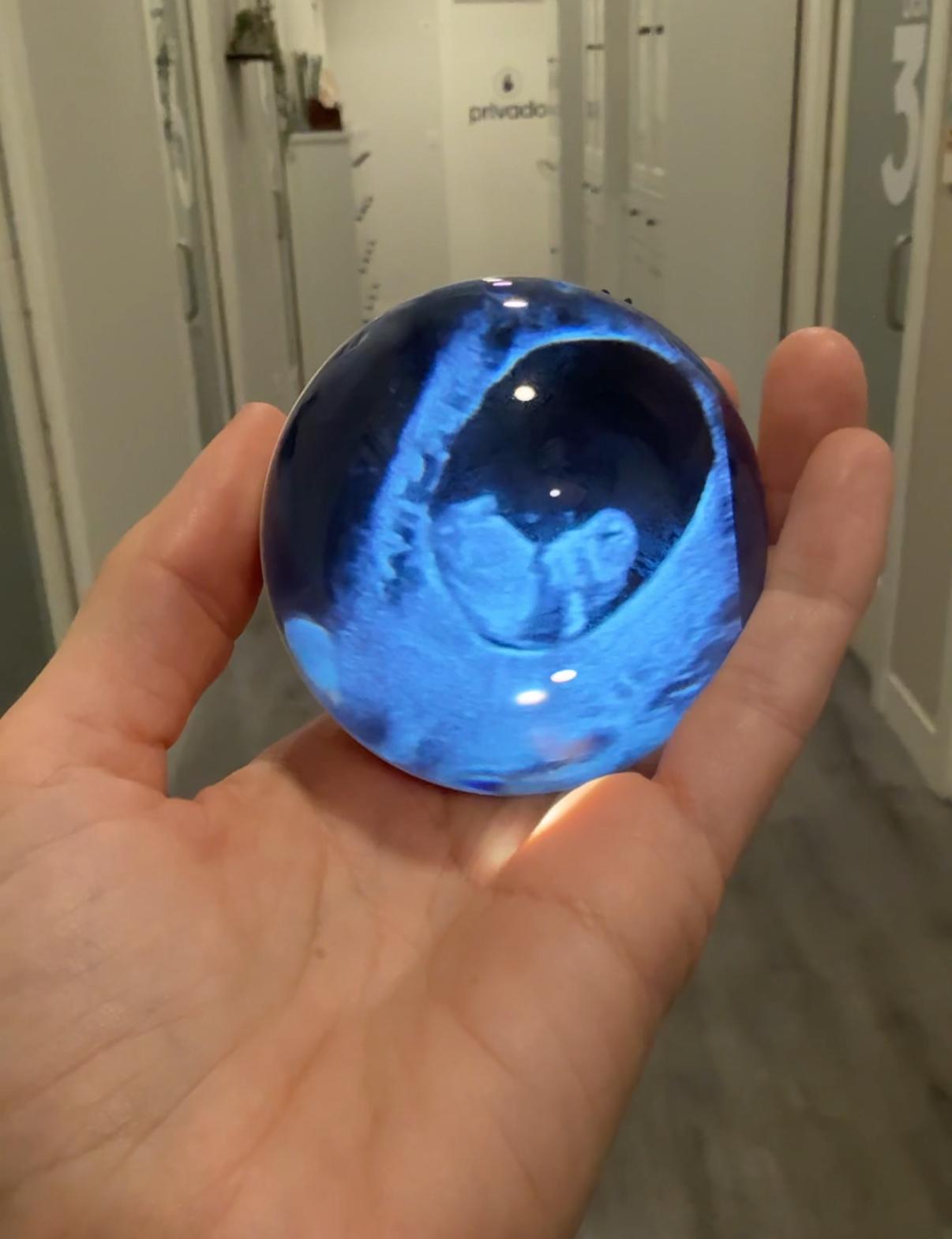 ecografía 2d en bilbao